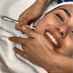 MICRODERMOABRASIÓN