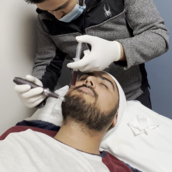 PLASMA FOLICULAR (BARBA)