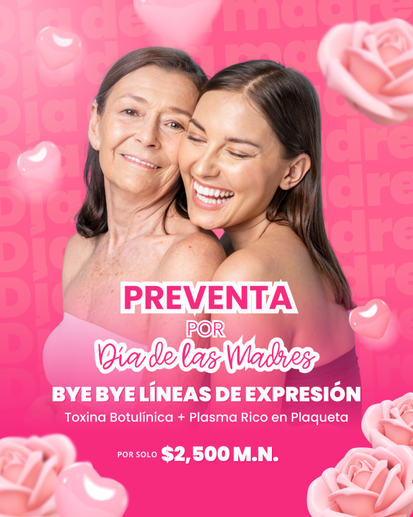 BYE BYE LÍNEAS DE EXPRESIÓN