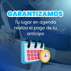 anticipos-moldearte