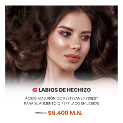 💋 LABIOS DE HECHIZO