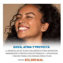 ELEVA, AFINA Y PROYECTA